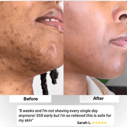 ShaveLess Serum - Skyn