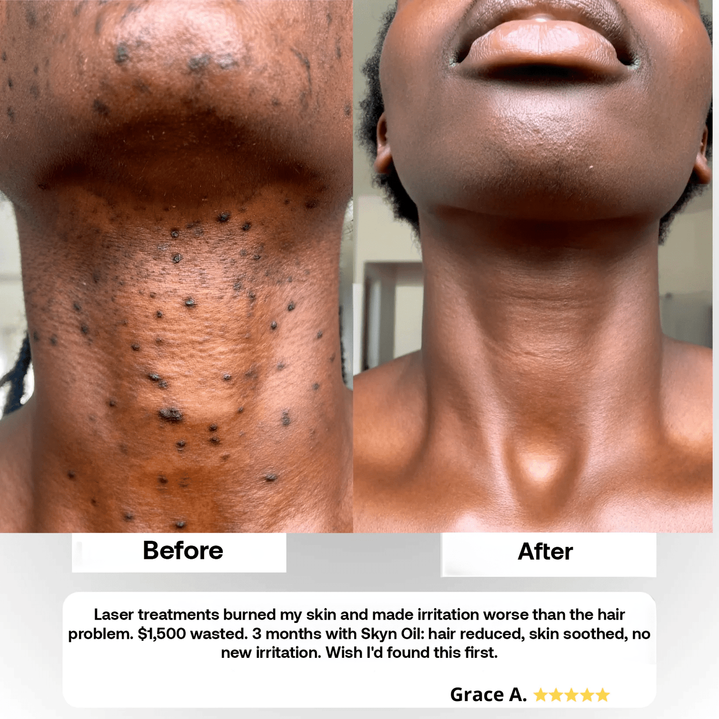 ShaveLess Serum - Skyn