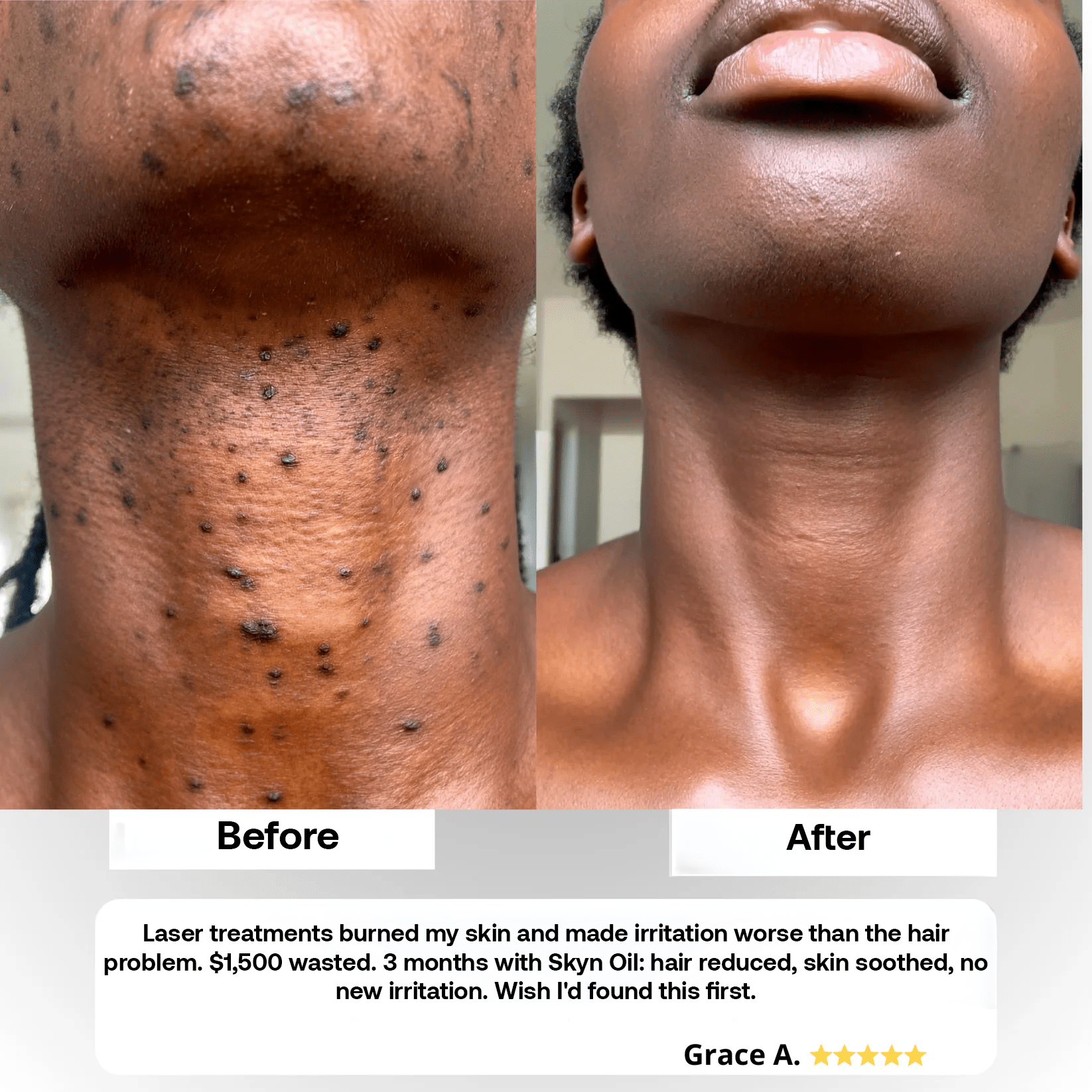 ShaveLess Serum - Skyn